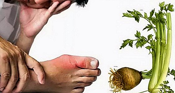 Features of the use of celery for gout