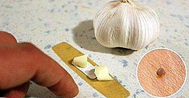 How to remove a wart using garlic? Different ways and contraindications