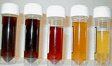 După sfecla, urina este roșie: de ce este așa, este normal, ar trebui să mă duc la doctor, schimbă culoarea mult timp?