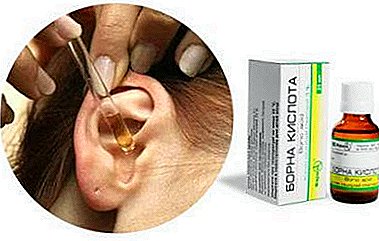 Un remedio simple: ¿es posible gotear ácido bórico en el oído? Contraindicaciones y duración del tratamiento.