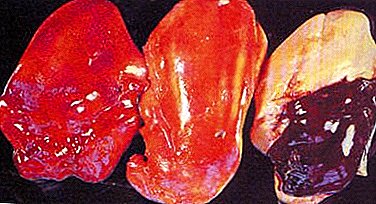 ما الذي يسبب السمنة الكبدية في الدجاج ويمكن تجنب ذلك؟